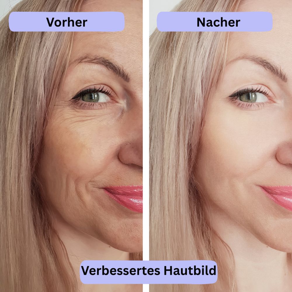 DermaPure 7% Glycolic Acid Toner